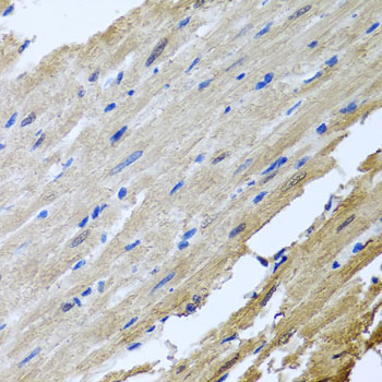 Immunohistochemistry of paraffin-embedded rat heart using CAMK2G Polyclonal Antibody at dilution of 1:100 (40x lens).Perform microwave antigen retrieval with 10 mM PBS buffer pH 7.2 before commencing with IHC staining protocol.