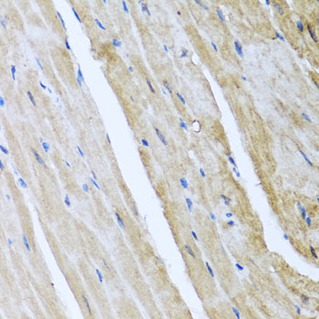 Immunohistochemistry of paraffin-embedded mouse heart using CAMK2G Polyclonal Antibody at dilution of 1:100 (40x lens).Perform microwave antigen retrieval with 10 mM PBS buffer pH 7.2 before commencing with IHC staining protocol.