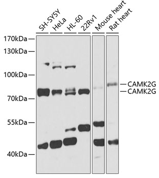 Western blot analysis of extracts of various cell lines using CAMK2G Polyclonal Antibody at 1:1000 dilution.