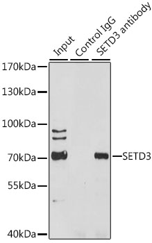 Immunoprecipitation analysis of 200ug extracts of HeLa cells using 3 ug SETD3 Polyclonal Antibody.Western blot was performed from the immunoprecipitate using SETD3 Polyclonal Antibody at a dilution of 1:1000.