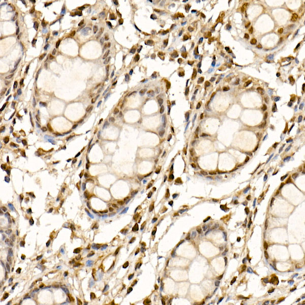 Immunohistochemistry of paraffin-embedded human colon using Cullin 1 Polyclonal Antibody at dilution of 1:50 (40x lens).Perform high pressure antigen retrieval with 10 mM citrate buffer pH 6.0 before commencing with IHC staining protocol.