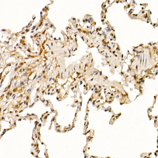 Immunohistochemistry of paraffin-embedded rat lung using Cullin 1 Polyclonal Antibody at dilution of 1:50 (40x lens).Perform high pressure antigen retrieval with 10 mM citrate buffer pH 6.0 before commencing with IHC staining protocol.