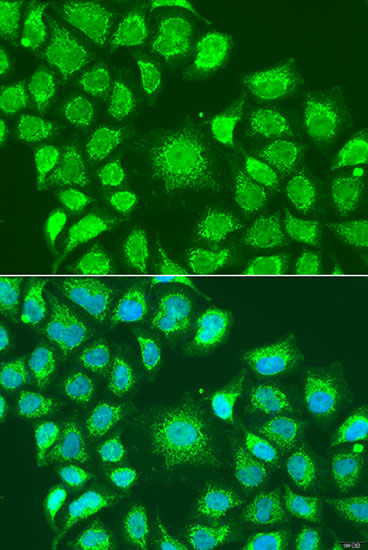 Immunofluorescence analysis of U2OS cells using ATG4D Polyclonal Antibody at dilution of 1:100. Blue: DAPI for nuclear staining.