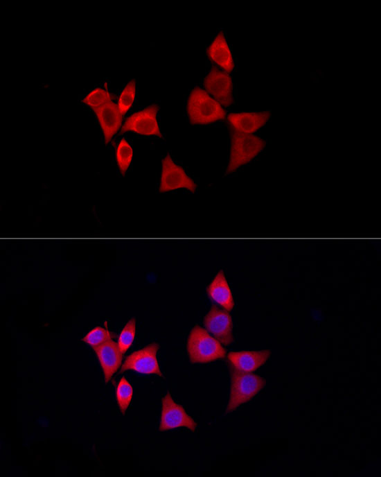 Immunofluorescence analysis of NIH-3T3 using PDXK Polyclonal Antibody at dilution of 1:100 (40x lens). Blue: DAPI for nuclear staining.