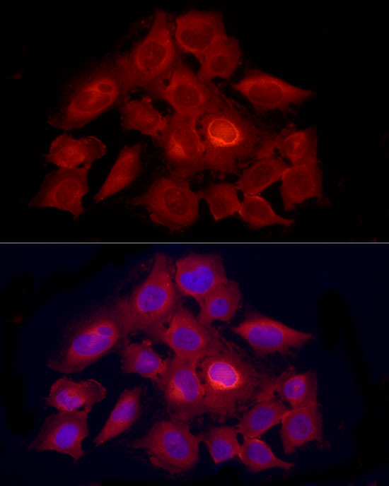 Immunofluorescence analysis of HeLa using PDXK Polyclonal Antibody at dilution of 1:100 (40x lens). Blue: DAPI for nuclear staining.