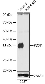 Western blot analysis of extracts from normal (control) and PDXK knockout (KO) 293T cells, using PDXK Polyclonal Antibody at 1:1000 dilution.