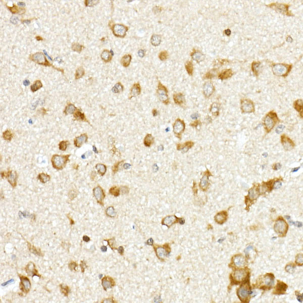 Immunohistochemistry of paraffin-embedded rat brain using hnRNP E1/PCBP1 Polyclonal Antibody at dilution of 1:100 (40x lens).Perform high pressure antigen retrieval with 10 mM citrate buffer pH 6.0 before commencing with IHC staining protocol.