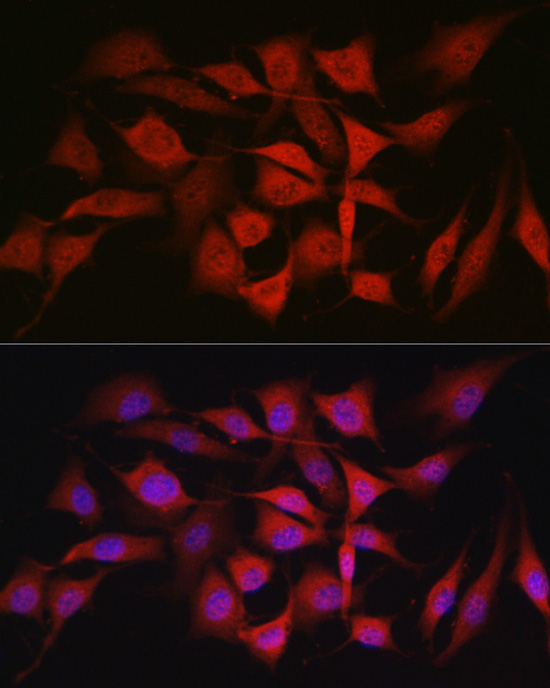 Immunofluorescence analysis of NIH/3T3 cells using Smad1 Polyclonal Antibody at dilution of 1:50 (40x lens). Blue: DAPI for nuclear staining.