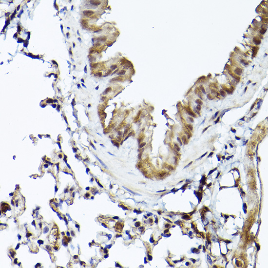 Immunohistochemistry of paraffin-embedded mouse lung using Smad1 Polyclonal Antibody at dilution of 1:50 (40x lens).Perform high pressure antigen retrieval with 10 mM citrate buffer pH 6.0 before commencing with IHC staining protocol.