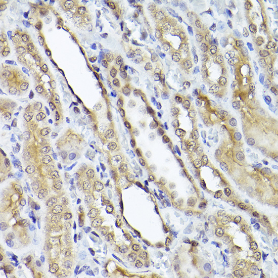 Immunohistochemistry of paraffin-embedded rat kidney using Smad1 Polyclonal Antibody at dilution of 1:50 (40x lens).Perform high pressure antigen retrieval with 10 mM citrate buffer pH 6.0 before commencing with IHC staining protocol.