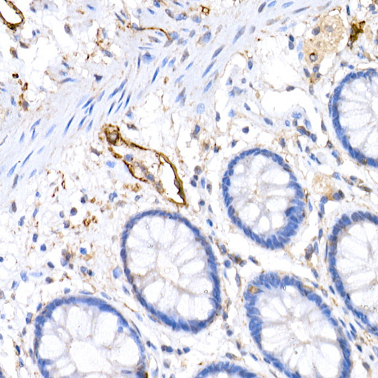 Immunohistochemistry of paraffin-embedded human colon using Podoplanin Polyclonal Antibody at dilution of 1:20 (40x lens).Perform high pressure antigen retrieval with 10 mM citrate buffer pH 6.0 before commencing with IHC staining protocol.