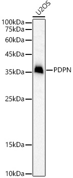 Western blot analysis of U2OS, using Podoplanin Polyclonal Antibody at 1:1000 dilution.