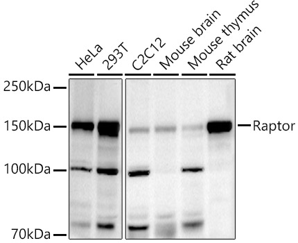 Western blot analysis of extracts of various cell lines using Raptor Polyclonal Antibody at 1:500 dilution.