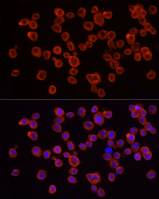 Immunofluorescence analysis of RAW264.7 cells using IRAK4 Polyclonal Antibody atdilution of 1:50 (40x lens). Blue: DAPI for nuclear staining.