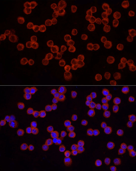 Immunofluorescence analysis of THP-1 cells using IRAK4 Polyclonal Antibody at dilution of 1:50 (40x lens). Blue: DAPI for nuclear staining.