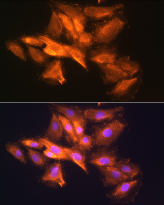 Immunofluorescence analysis of H9C2 cells using HINT1 Polyclonal Antibody at dilution of 1:100 (40x lens). Blue: DAPI for nuclear staining.