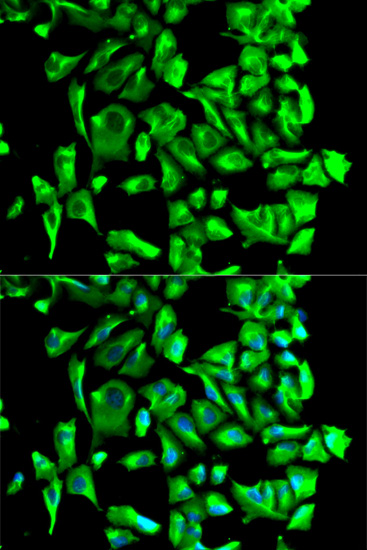 Immunofluorescence analysis of U2OS cells using HSP90AB1 Polyclonal Antibody. Blue: DAPI for nuclear staining.