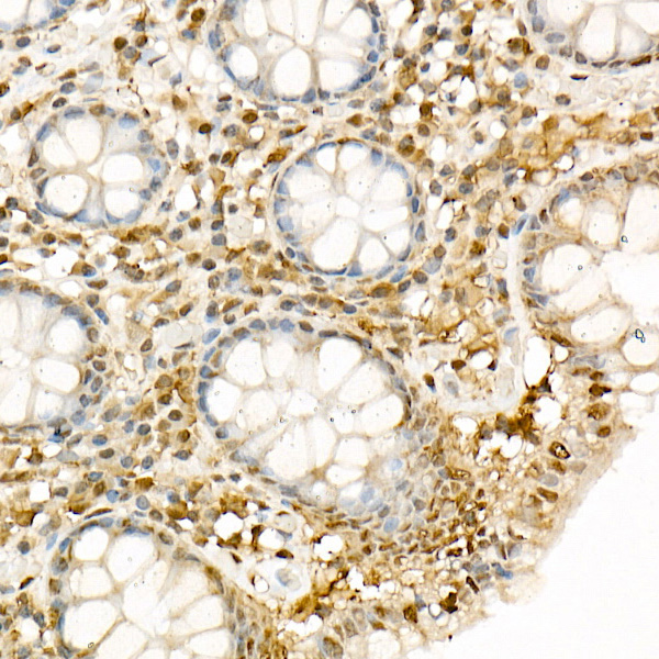 Immunohistochemistry of paraffin-embedded human colon using Hsp90β Polyclonal Antibody at dilution of 1:20 (40x lens).Perform high pressure antigen retrieval with 10 mM citrate buffer pH 6.0 before commencing with IHC staining protocol.