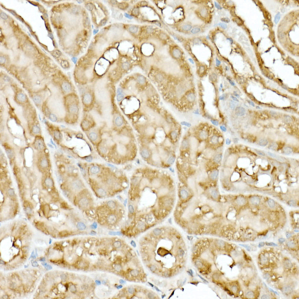 Immunohistochemistry of paraffin-embedded rat kidney using Hsp90β Polyclonal Antibody at dilution of 1:20 (40x lens).Perform high pressure antigen retrieval with 10 mM citrate buffer pH 6.0 before commencing with IHC staining protocol.