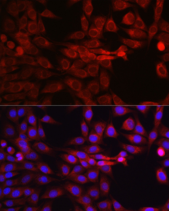 Immunofluorescence analysis of NIH/3T3 cells using SEC61B Polyclonal Antibody at dilution of 1:100 (40x lens). Blue: DAPI for nuclear staining.