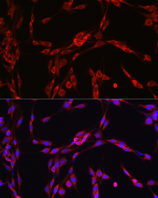 Immunofluorescence analysis of PC-12 cells using SEC61B Polyclonal Antibody at dilution of 1:100 (40x lens). Blue: DAPI for nuclear staining.