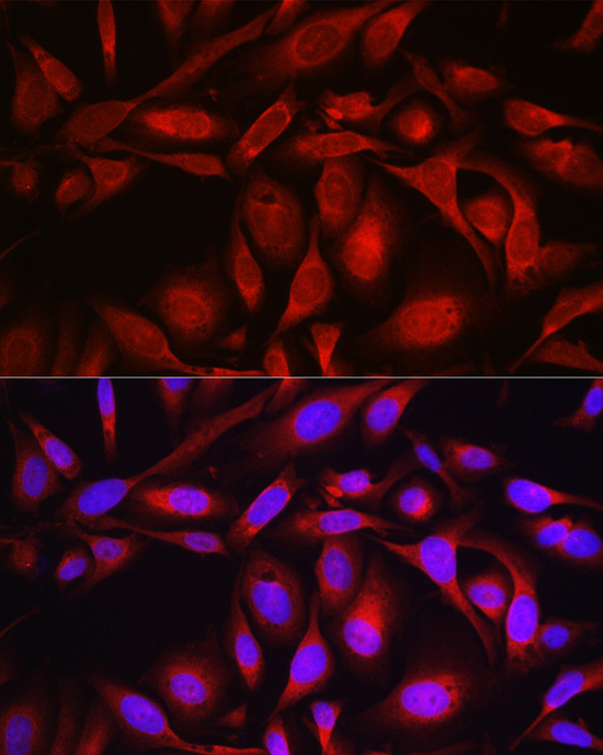 Immunofluorescence analysis of U2OS cells using SEC61B Polyclonal Antibody at dilution of 1:100 (40x lens). Blue: DAPI for nuclear staining.