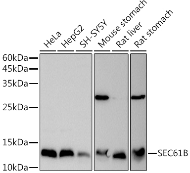 Western blot analysis of extracts of various cell lines using SEC61B Polyclonal Antibody at 1:1000 dilution.