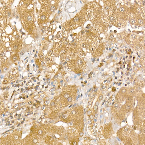 Immunohistochemistry of paraffin-embedded human liver using [KO Validated] CSNK1E Polyclonal Antibody atdilution of 1:200 (40x lens).Perform high pressure antigen retrieval with 10 mM citrate buffer pH 6.0 before commencing with IHC staining protocol.