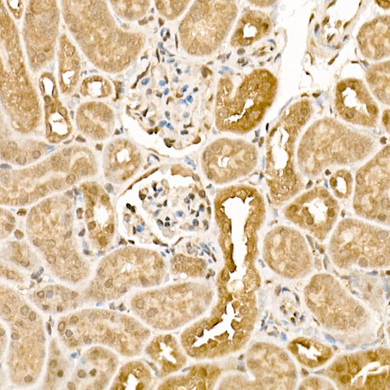 Immunohistochemistry of paraffin-embedded mouse kidney using [KO Validated] CSNK1E Polyclonal Antibody at dilution of 1:200 (40x lens).Perform high pressure antigen retrieval with 10 mM citrate buffer pH 6.0 before commencing with IHC staining protocol.