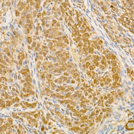 Immunohistochemistry of paraffin-embedded rat ovary using [KO Validated] CSNK1E Polyclonal Antibody at dilution of 1:200 (40x lens).Perform high pressure antigen retrieval with 10 mM citrate buffer pH 6.0 before commencing with IHC staining protocol.