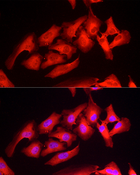 Immunofluorescence analysis of HeLa cells using Peroxiredoxin 2 Polyclonal Antibody at dilution of 1:50 (40x lens). Blue: DAPI for nuclear staining.