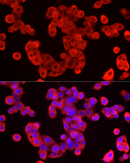 Immunofluorescence analysis of HepG2 cells using Peroxiredoxin 2 Polyclonal Antibody at dilution of 1:50 (40x lens). Blue: DAPI for nuclear staining.