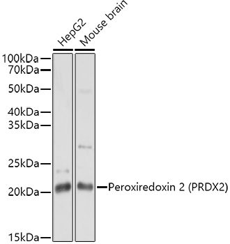 Western blot analysis of extracts of various cell lines using Peroxiredoxin 2 Polyclonal Antibody at1:1000 dilution.