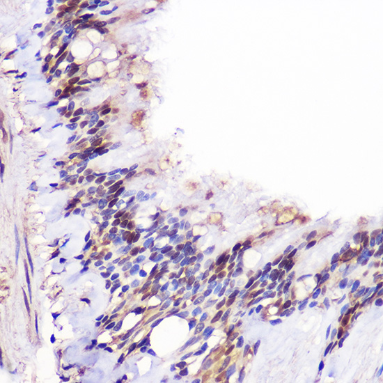 Immunohistochemistry of paraffin-embedded human lung using JMJD6 Polyclonal Antibody atdilution of 1:100 (40x lens).Perform high pressure antigen retrieval with 10 mM citrate buffer pH 6.0 before commencing with IHC staining protocol.