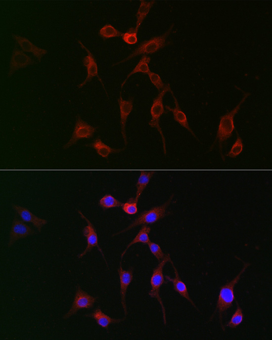 Immunofluorescence analysis of BALB-3T3 cells using [KO Validated] TAGLN2 Polyclonal Antibody at dilution of 1:100 (40x lens). Blue: DAPI for nuclear staining.