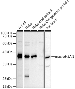 Western blot analysis of extracts of various cell lines using macroH2A.1 Polyclonal Antibody at 1:1000 dilution.