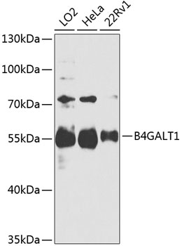 Western blot analysis of extracts of various cell lines using B4GALT1 Polyclonal Antibody at 1:1000 dilution.