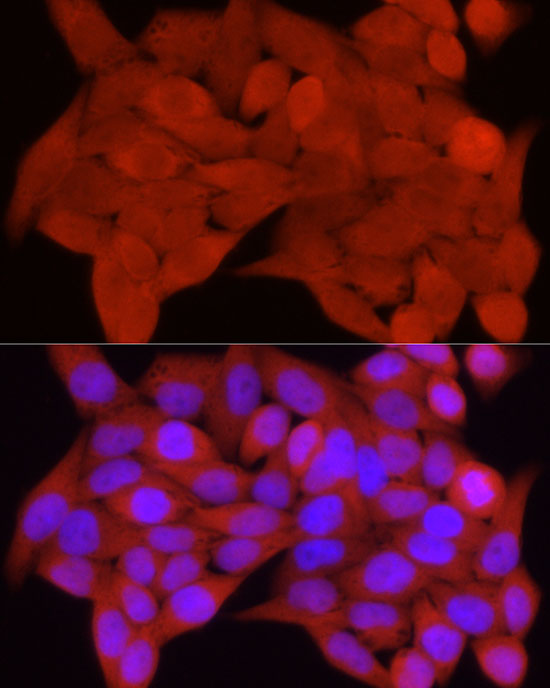 Immunofluorescence analysis of HeLa cells using S100A11 Polyclonal Antibody at dilution of 1:50 (40x lens). Blue: DAPI for nuclear staining.