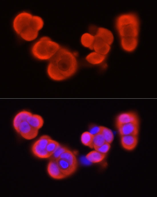 Immunofluorescence analysis of MCF7 cells using S100A11 Polyclonal Antibody at dilution of 1:50 (40x lens). Blue: DAPI for nuclear staining.