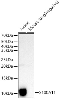 Western blot analysis of extracts of various cell lines using S100A11 Polyclonal Antibody at 1:400 dilution.