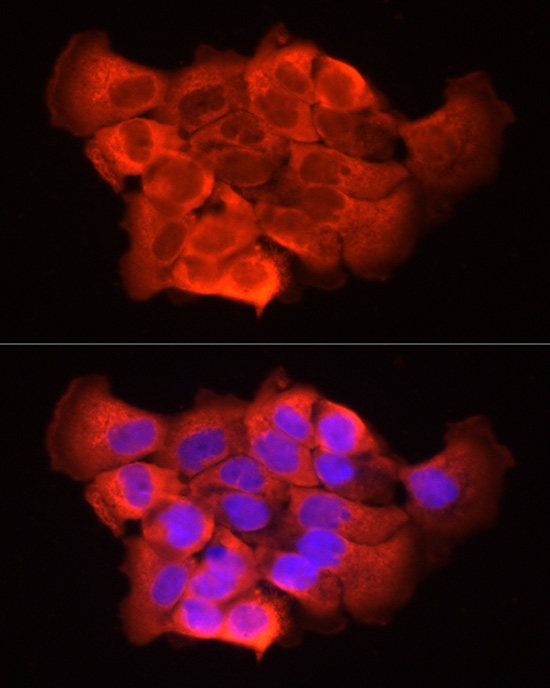 Immunofluorescence analysis of A431 cells using [KD Validated] SFRP2 Polyclonal Antibody at dilution of 1:50 (40x lens). Blue: DAPI for nuclear staining.