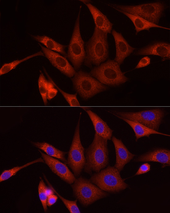 Immunofluorescence analysis of NIH/3T3 cells using [KD Validated] SFRP2 Polyclonal Antibody at dilution of 1:50 (40x lens). Blue: DAPI for nuclear staining.