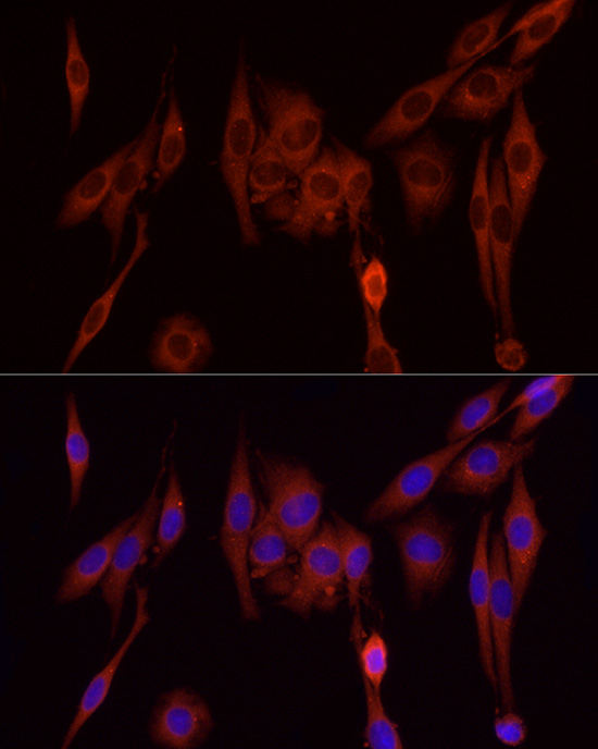 Immunofluorescence analysis of PC-12 cells using [KD Validated] SFRP2 Polyclonal Antibody at dilution of 1:50 (40x lens). Blue: DAPI for nuclear staining.