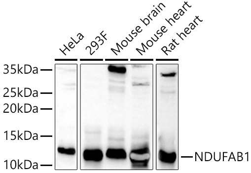 Western blot analysis of extracts of various cell lines using NDUFAB1 Polyclonal Antibody at 1:1000 dilution.