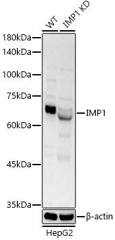 Western blot analysis of extracts from normal (control) and knockdown (KD) HepG2 cells, using ZEB1 Polyclonal Antibody at 1:500 dilution.