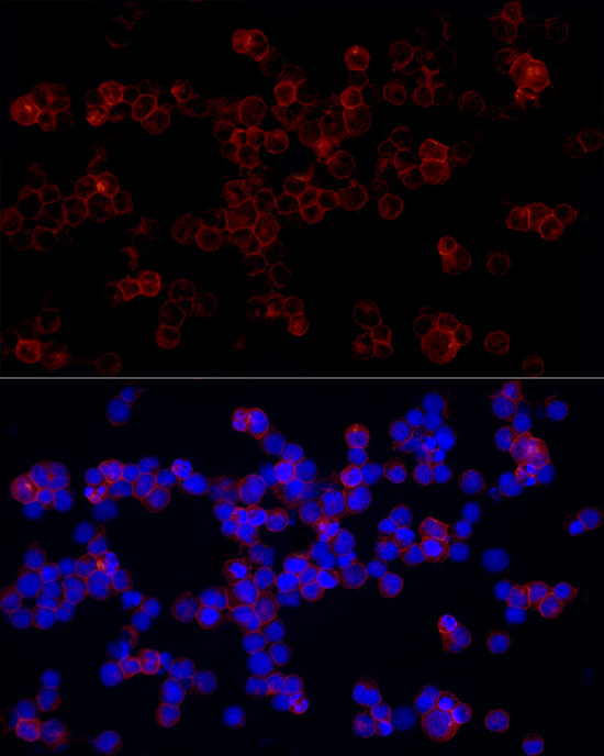 Immunofluorescence analysis of Daudi cells using CD85j Polyclonal Antibody at dilution of 1:100 (40x lens). Blue: DAPI for nuclear staining.