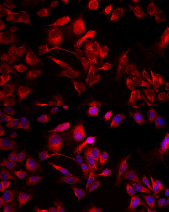 Immunofluorescence analysis of HeLa cells using [KD Validated] RHOT1/MIRO1 Polyclonal Antibody at dilution of 1:50 (40x lens). Blue: DAPI for nuclear staining.