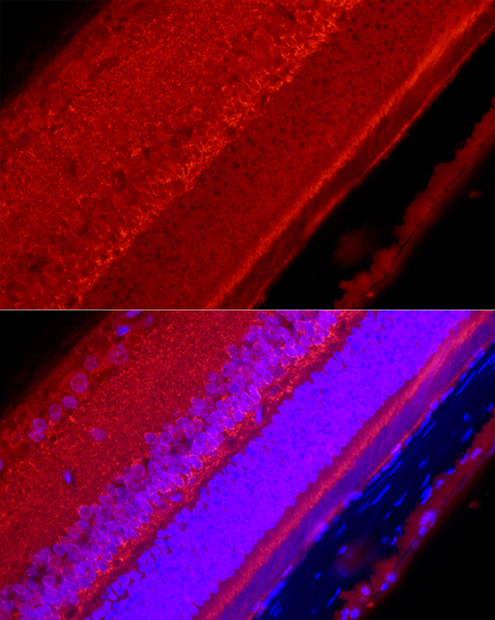 Immunofluorescence analysis of rat eye cells using POU4F1Polyclonal Antibody at dilution of 1:50 (40x lens). Blue: DAPI for nuclear staining.