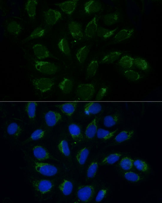 Immunofluorescence analysis of U20S cells using ATAD3A/ATAD3B Polyclonal Antibody at dilution of 1:100 (40x lens).Blue: DAPI for nuclear staining.