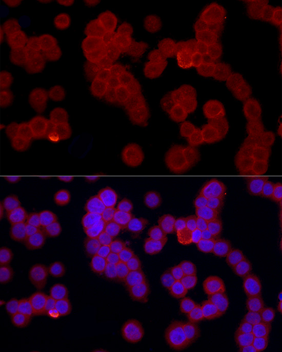 Immunofluorescence analysis of HL-60 cells using FPR2 Polyclonal Antibody atdilution of 1:50 (40x lens). Blue: DAPI for nuclear staining.